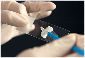 Papa test na infekci papilomavirus