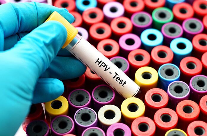 Krevní test na lidský papilomavirus